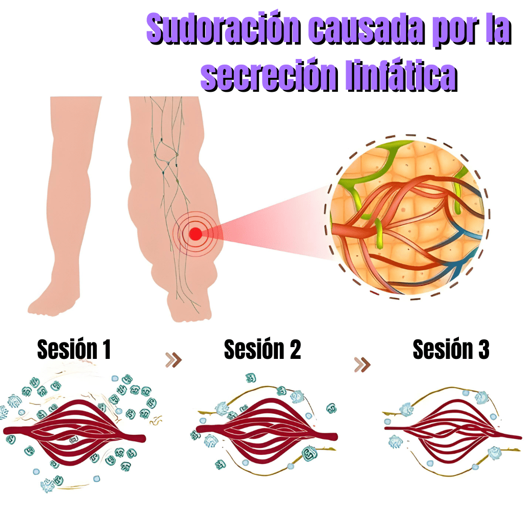 Linfatic™ Instrumento linfático ultrasónico