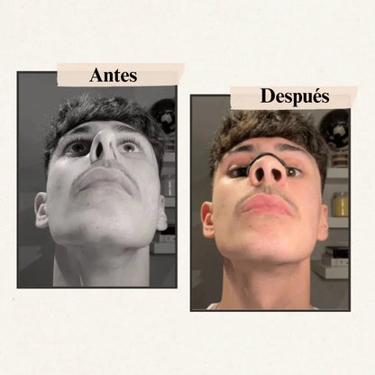 UpLife™ - Más oxigeno, más Vida.